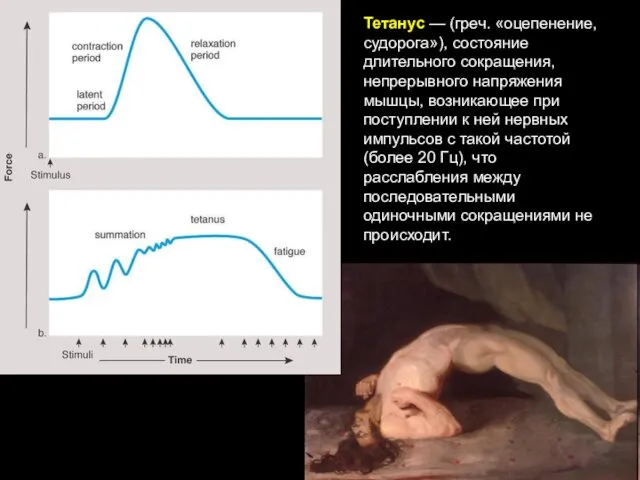 Тетанус — (греч. «оцепенение, судорога»), состояние длительного сокращения, непрерывного напряжения мышцы,