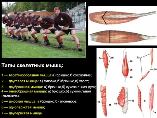 1 — веретенообразная мышца:а) брюшко,б)сухожилие; 2 — двуглавая мышца: а) головка,б)