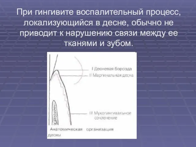 При гингивите воспалительный процесс, локализующийся в десне, обычно не приводит к