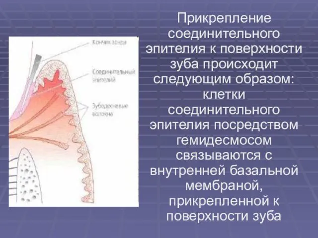 Прикрепление соединительного эпителия к поверхности зуба происходит следующим образом: клетки соединительного