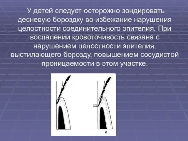 У детей следует осторожно зондировать десневую бороздку во избежание нарушения целостности