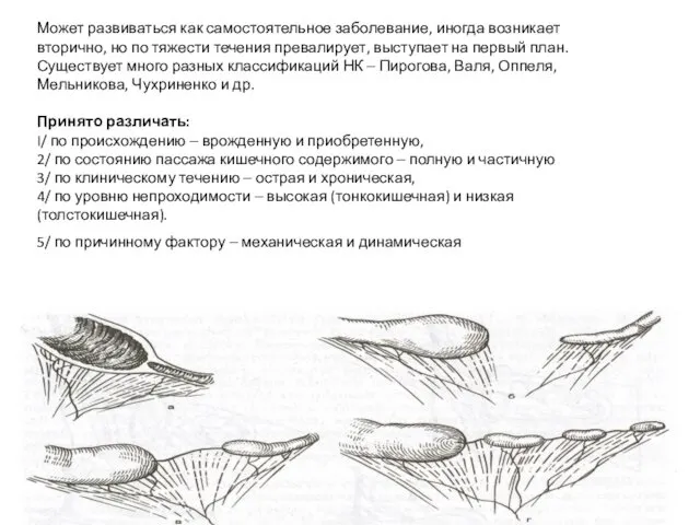 Может развиваться как самостоятельное заболевание, иногда возникает вторично, но по тяжести