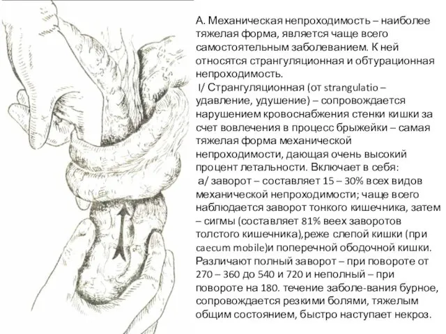 А. Механическая непроходимость – наиболее тяжелая форма, является чаще всего самостоятельным