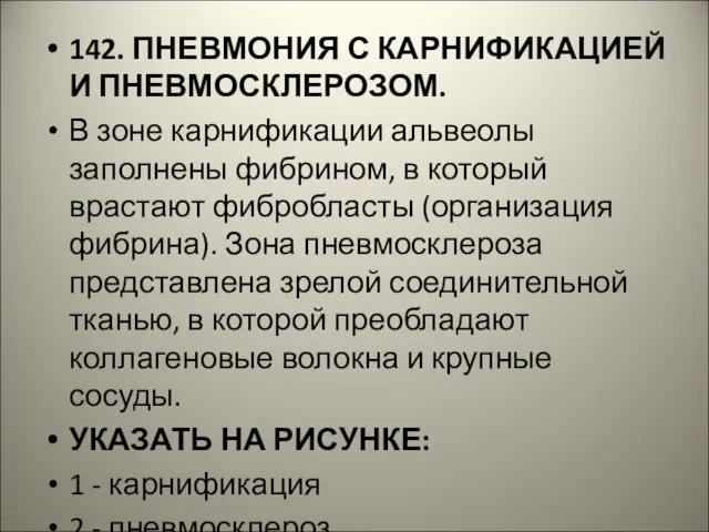 142. ПНЕВМОНИЯ С КАРНИФИКАЦИЕЙ И ПНЕВМОСКЛЕРОЗОМ. В зоне карнификации альвеолы заполнены