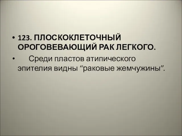 123. ПЛОСКОКЛЕТОЧНЫЙ ОРОГОВЕВАЮЩИЙ РАК ЛЕГКОГО. Среди пластов атипического эпителия видны “раковые жемчужины”.