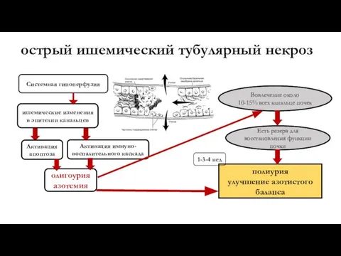 острый ишемический тубулярный некроз Системная гипоперфузия ишемические изменения в эпителии канальцев