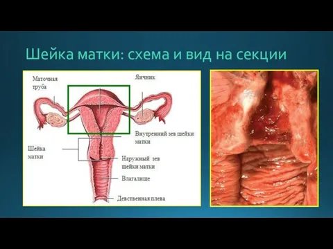 Шейка матки: схема и вид на секции