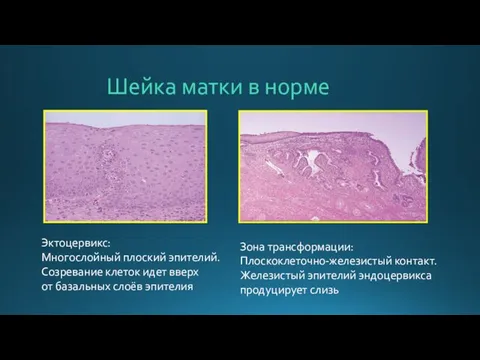 Шейка матки в норме Эктоцервикс: Многослойный плоский эпителий. Созревание клеток идет