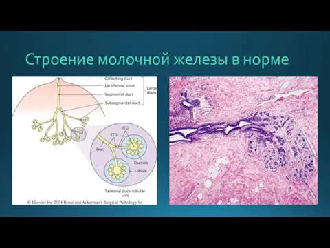 Строение молочной железы в норме