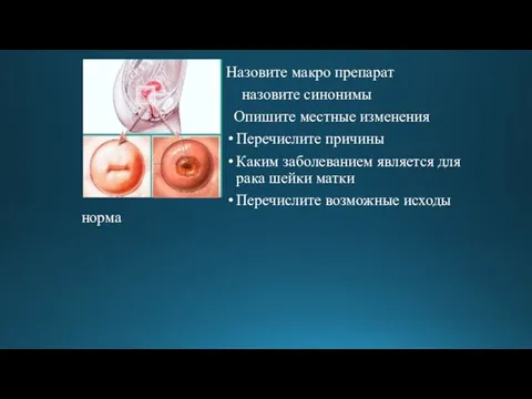 Назовите макро препарат назовите синонимы Опишите местные изменения Перечислите причины Каким