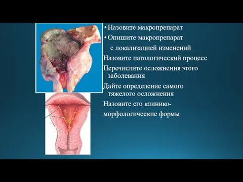 Назовите макропрепарат Опишите макропрепарат с локализацией изменений Назовите патологический процесс Перечислите