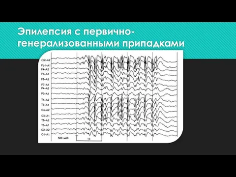 Эпилепсия с первично-генерализованными припадками