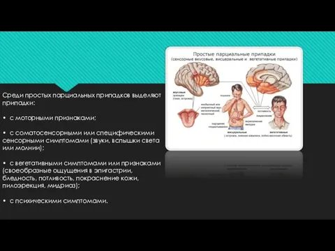 Среди простых парциальных припадков выделяют припадки: • с моторными признаками; •