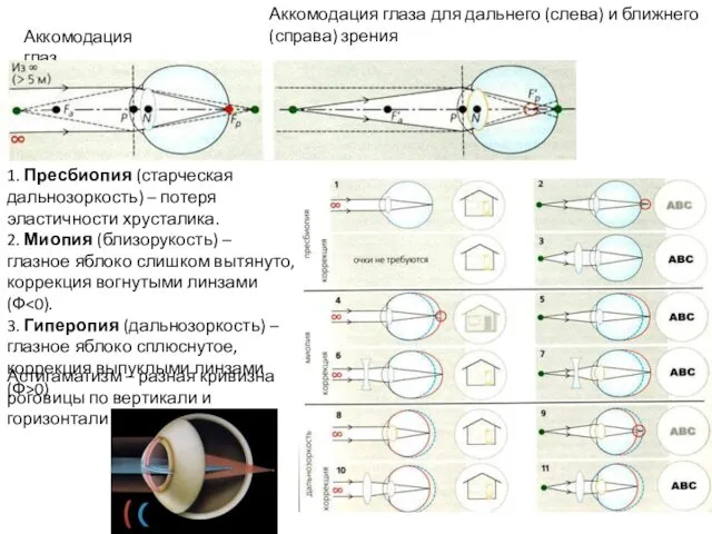 Аккомодация глаз Аккомодация глаза для дальнего (слева) и ближнего (справа) зрения