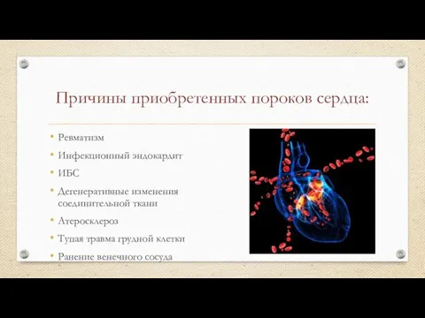 Причины приобретенных пороков сердца: Ревматизм Инфекционный эндокардит ИБС Дегенеративные изменения соединительной