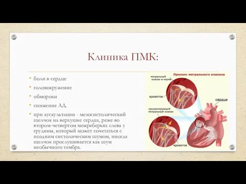 Клиника ПМК: боли в сердце головокружение обмороки снижение АД. при аускультации