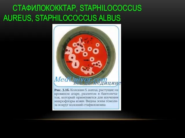 СТАФИЛОКОККТАР, STAPHILOCOCCUS AUREUS, STAPHILOCOCCUS ALBUS