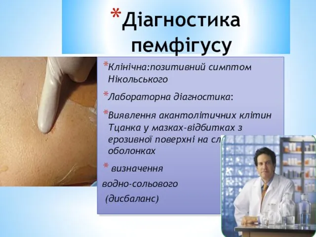 Діагностика пемфігусу Клінічна:позитивний симптом Нікольського Лабораторна діагностика: Виявлення акантолітичних клітин Тцанка