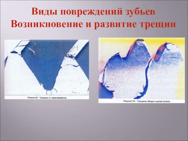 Виды повреждений зубьев Возникновение и развитие трещин