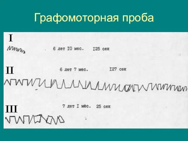 Графомоторная проба