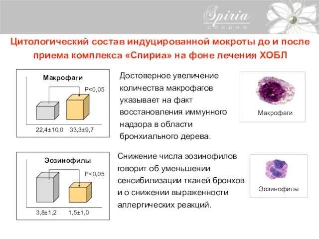 Цитологический состав индуцированной мокроты до и после приема комплекса «Спириа» на