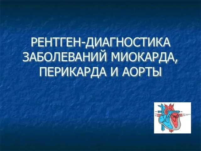 РЕНТГЕН-ДИАГНОСТИКА ЗАБОЛЕВАНИЙ МИОКАРДА, ПЕРИКАРДА И АОРТЫ