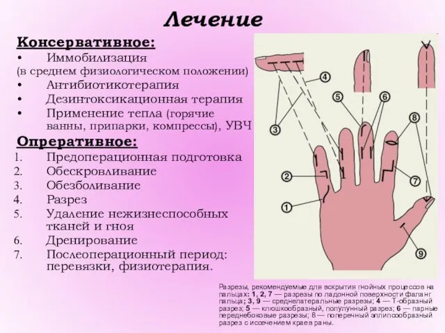 Лечение Консервативное: Иммобилизация (в среднем физиологическом положении) Антибиотикотерапия Дезинтоксикационная терапия Применение