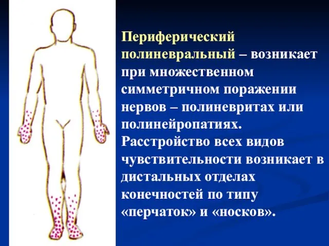 Периферический полиневральный – возникает при множественном симметричном поражении нервов – полиневритах