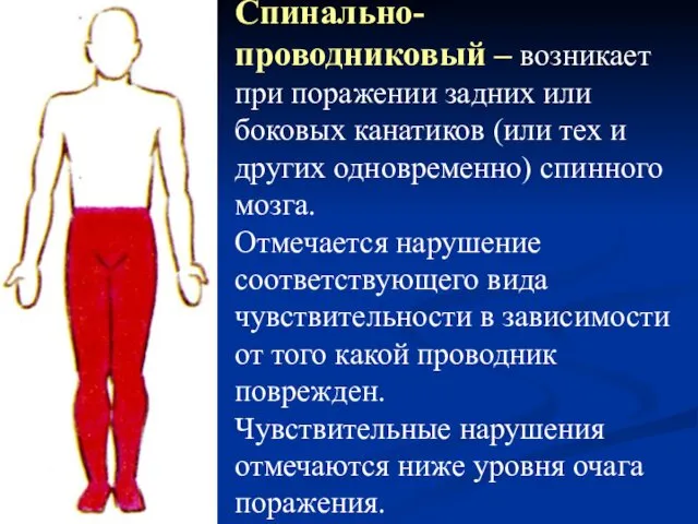 Спинально-проводниковый – возникает при поражении задних или боковых канатиков (или тех