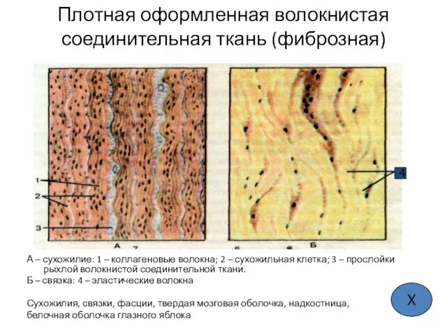 Плотная оформленная волокнистая соединительная ткань (фиброзная) А – сухожилие: 1 –