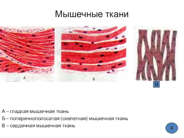 Мышечные ткани А – гладкая мышечная ткань Б – поперечнополосатая (скелетная)