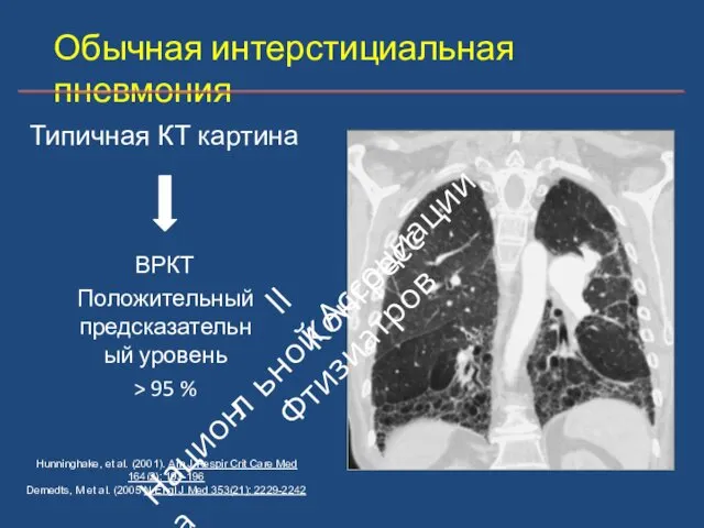 Обычная интерстициальная пневмония ВРКТ Положительный предсказательный уровень > 95 % Hunninghake,