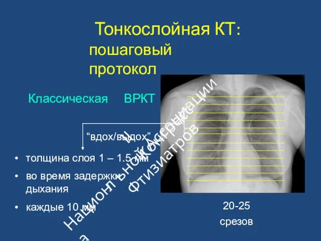 Тонкослойная КТ: пошаговый протокол Классическая ВРКТ “вдох/выдох” толщина слоя 1 –