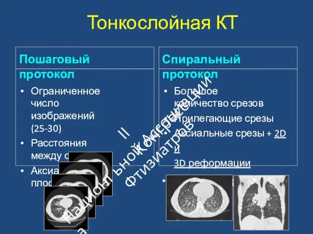 Тонкослойная КТ Пошаговый протокол Ограниченное число изображений (25‐30) Расстояния между срезами