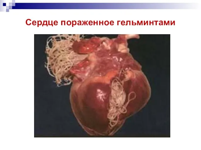 Сердце пораженное гельминтами