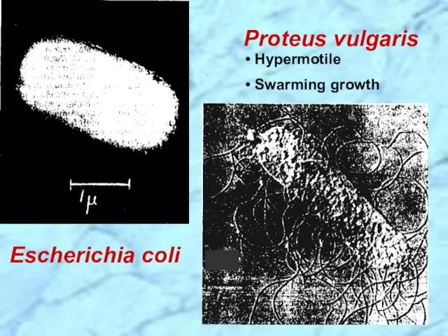 Escherichia coli Hypermotile Swarming growth Proteus vulgaris