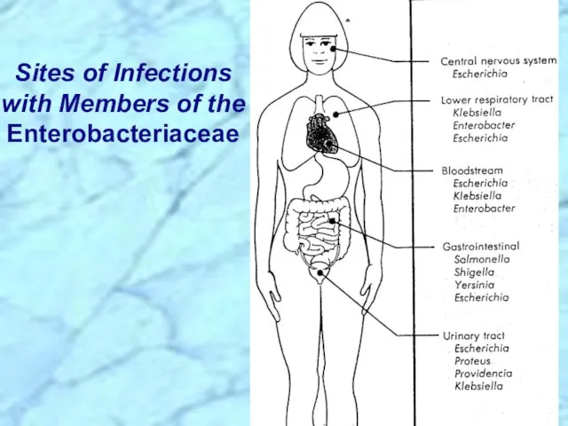 Sites of Infections with Members of the Enterobacteriaceae