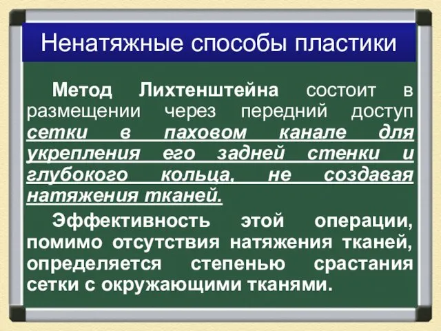 Ненатяжные способы пластики Метод Лихтенштейна состоит в размещении через передний доступ