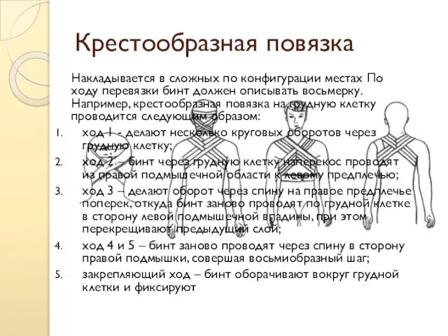 Крестообразная повязка Накладывается в сложных по конфигурации местах По ходу перевязки