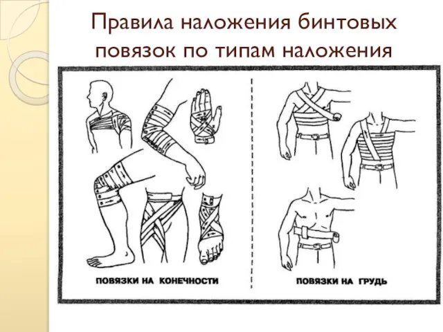 Правила наложения бинтовых повязок по типам наложения