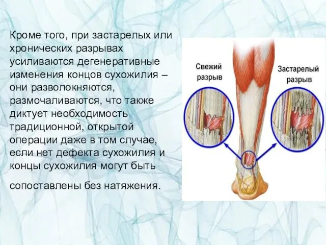 Кроме того, при застарелых или хронических разрывах усиливаются дегенеративные изменения концов