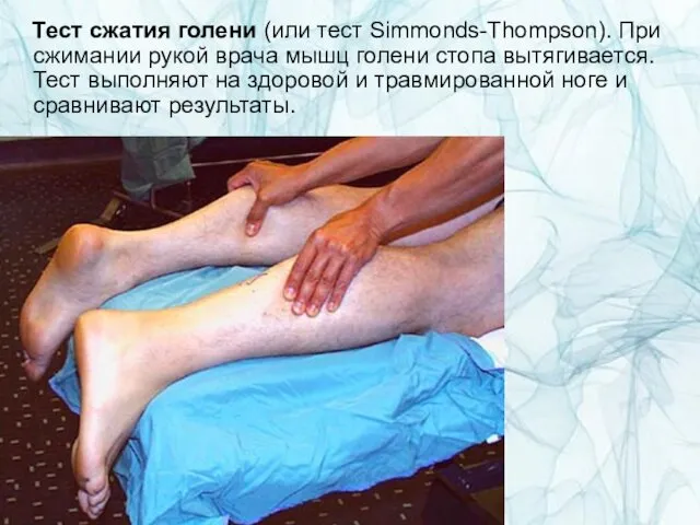 Тест сжатия голени (или тест Simmonds-Thompson). При сжимании рукой врача мышц