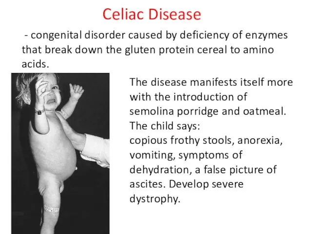 - congenital disorder caused by deficiency of enzymes that break down