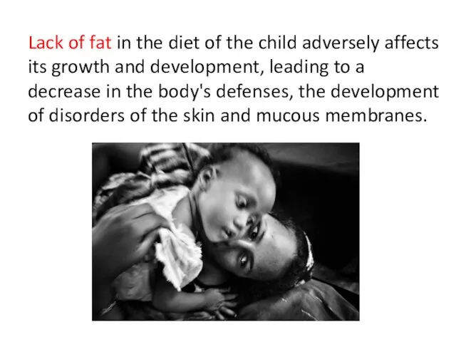 Lack of fat in the diet of the child adversely affects