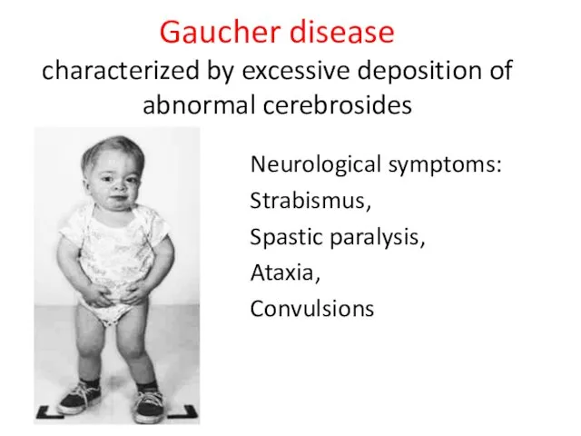 Gaucher disease characterized by excessive deposition of abnormal cerebrosides Neurological symptoms: Strabismus, Spastic paralysis, Ataxia, Convulsions