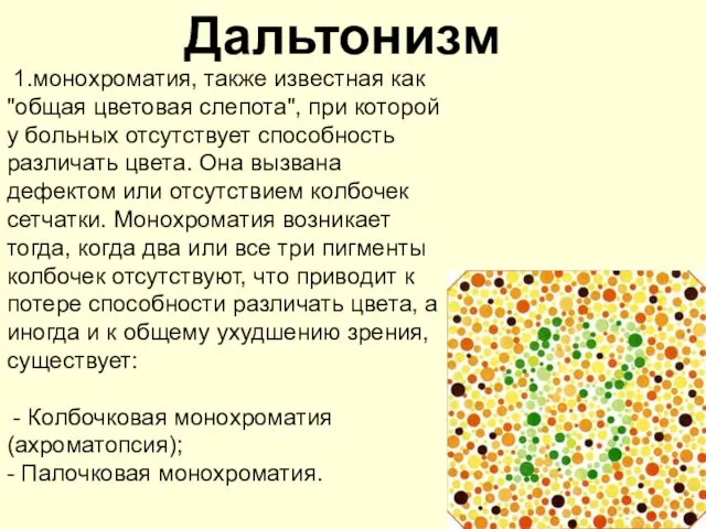 Дальтонизм 1.монохроматия, также известная как "общая цветовая слепота", при которой у