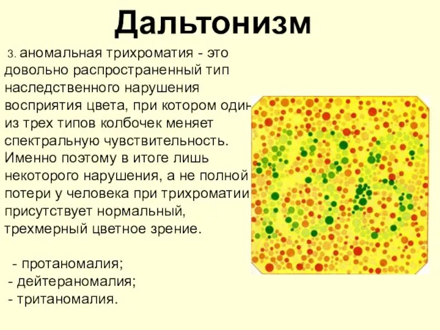 Дальтонизм 3. аномальная трихроматия - это довольно распространенный тип наследственного нарушения