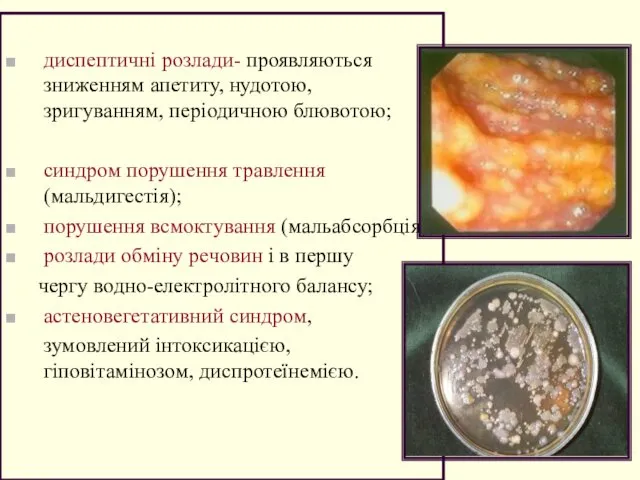 диспептичні розлади- проявляються зниженням апетиту, нудотою, зригуванням, періодичною блювотою; синдром порушення