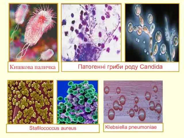 Кишкова паличка Патогенні гриби роду Candida Stafilococcus aureus Klebsiella pneumoniae