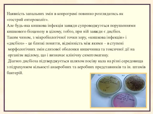 Наявність запальних змін в копрограмі повинно розглядатись як «гострий ентероколіт». Але